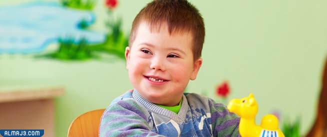 أعراض متلازمة داون