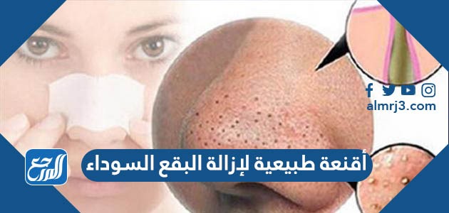 أقنعة طبيعية لإزالة البقع السوداء