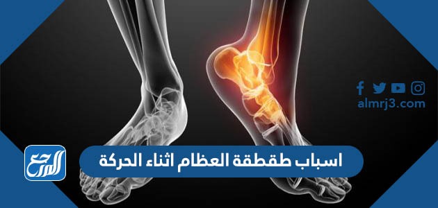 اسباب طقطقة العظام اثناء الحركة