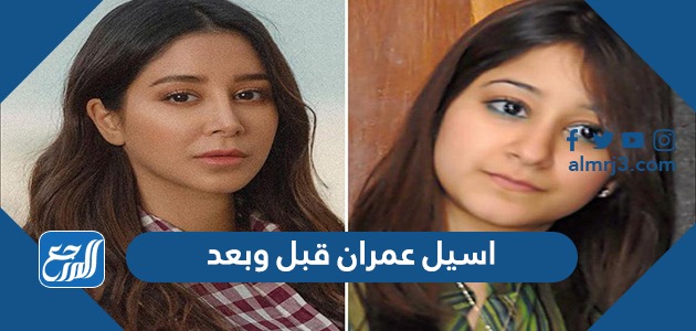 اسيل عمران قبل وبعد