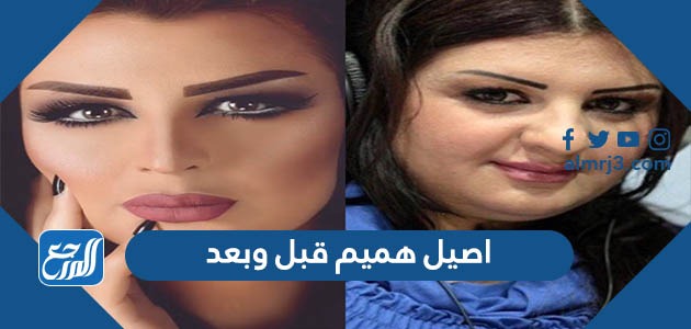 اصيل هميم قبل وبعد