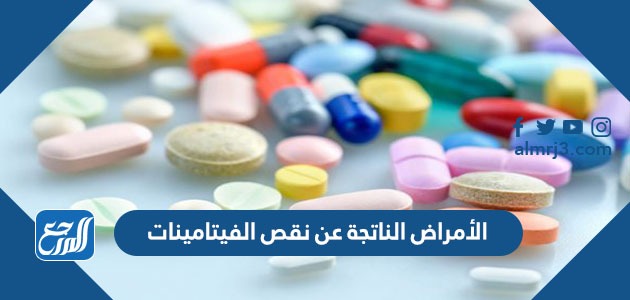 الأمراض الناتجة عن نقص الفيتامينات