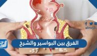 الفرق بين البواسير والشرخ