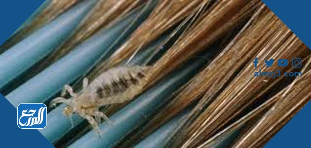 القمل في الشعر