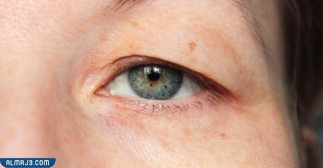 المرحلة الأولى وهي مرحلة ما قبل إجراء العملية