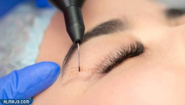 المرحلة الثانية وهي مرحلة إجراء العملية