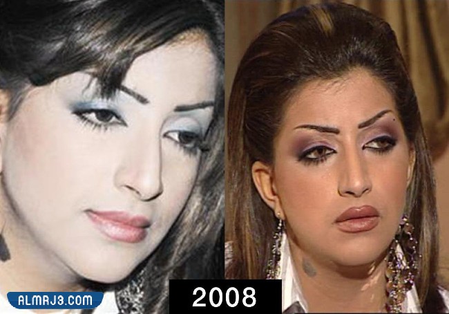 بثينة الرئيسي قبل التجميل