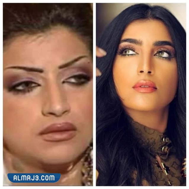 بثينة الرئيسي قبل وبعد