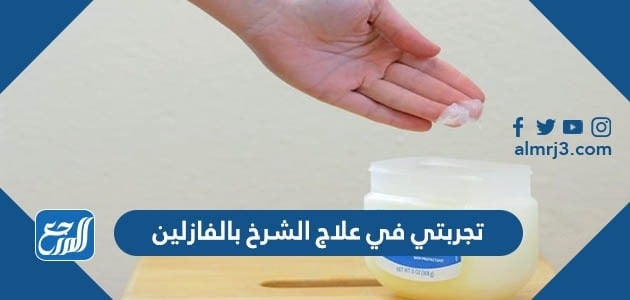 تجربتي في علاج الشرخ بالفازلين
