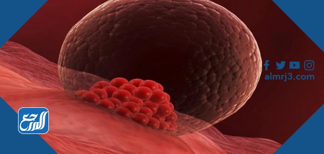 تعلق البويضة بالرحم