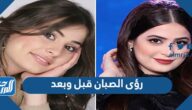 رؤى الصبان قبل وبعد