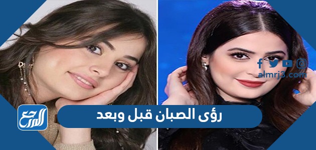 رؤى الصبان قبل وبعد