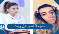 سمية الناصر قبل وبعد