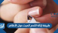 طريقة إزالة اللحم الميت حول الأظافر