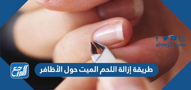 طريقة إزالة اللحم الميت حول الأظافر