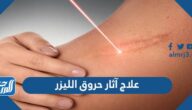 علاج آثار حروق الليزر