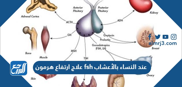 علاج ارتفاع هرمون fsh عند النساء بالأعشاب