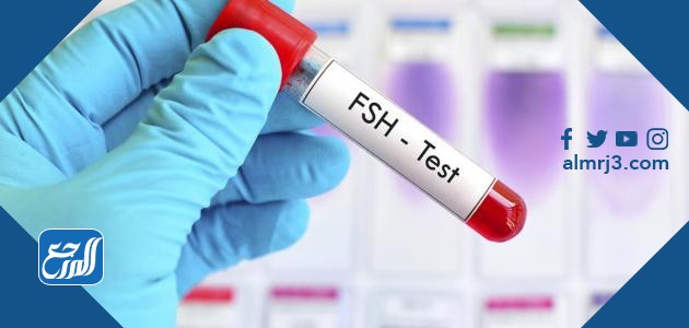 علاج ارتفاع هرمون fsh