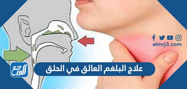 علاج البلغم العالق في الحلق