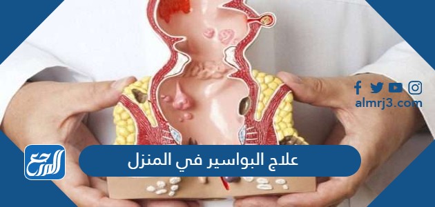 علاج البواسير في المنزل