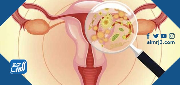 افرازات بيضاء مثل قطع المناديل