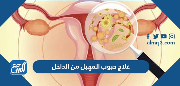 علاج حبوب المهبل من الداخل