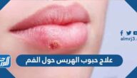علاج حبوب الهربس حول الفم