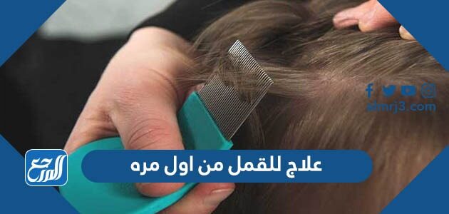 علاج للقمل من أول مرة