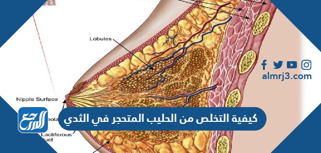 كيفية التخلص من الحليب المتحجر في الثدي