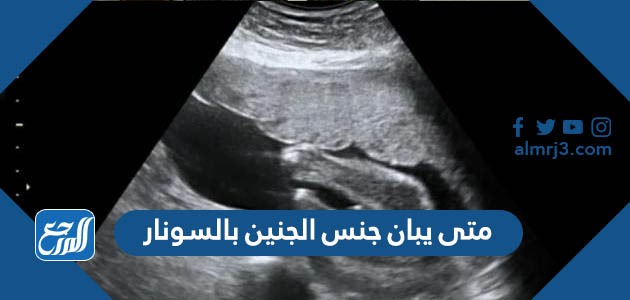 متى يبان جنس الجنين بالسونار