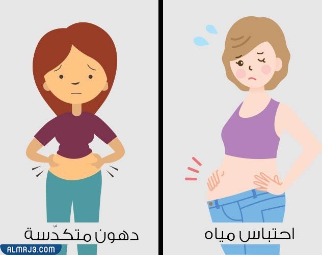 من أسباب انتفاخ البطن احتباس المياه وتكدس الدهون