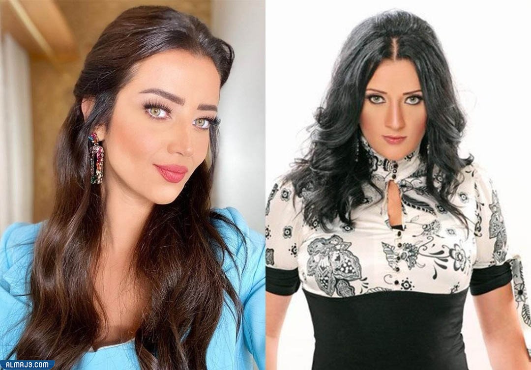 رضوى الشربيني قبل عملية التجميل