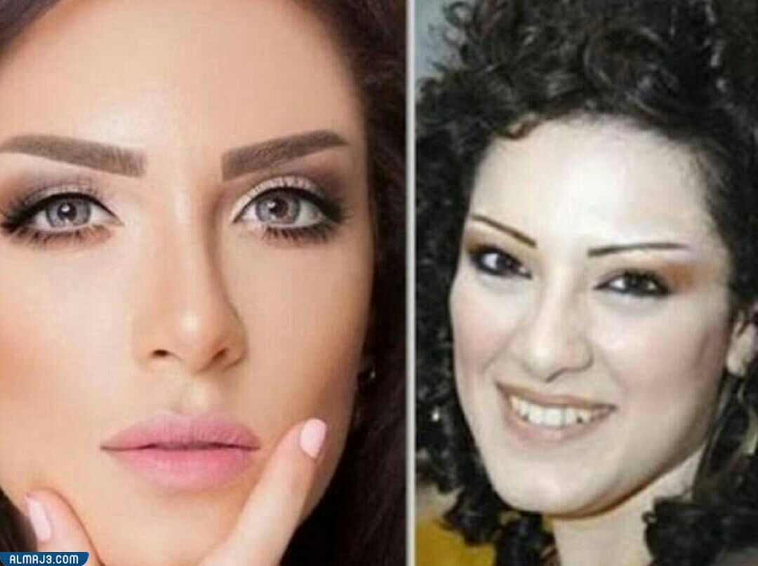 هبة الدري قبل وبعد