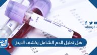 هل تحليل الدم الشامل يكشف الايدز
