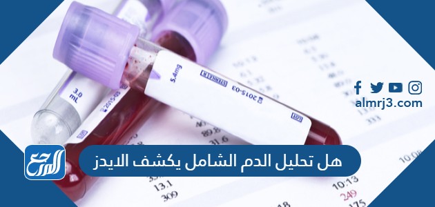 هل تحليل الدم الشامل يكشف الايدز