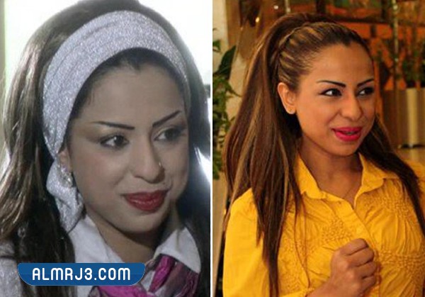 هند البلوشي قبل التجميل