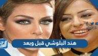 هند البلوشي قبل وبعد هند البلوشي قبل وبعد