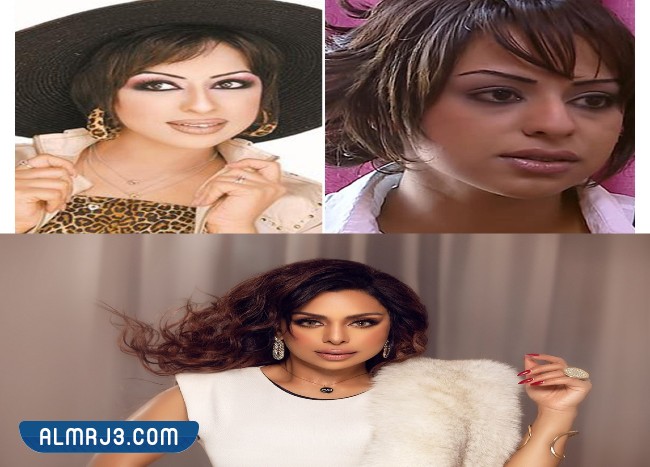 هند البلوشي قبل وبعد