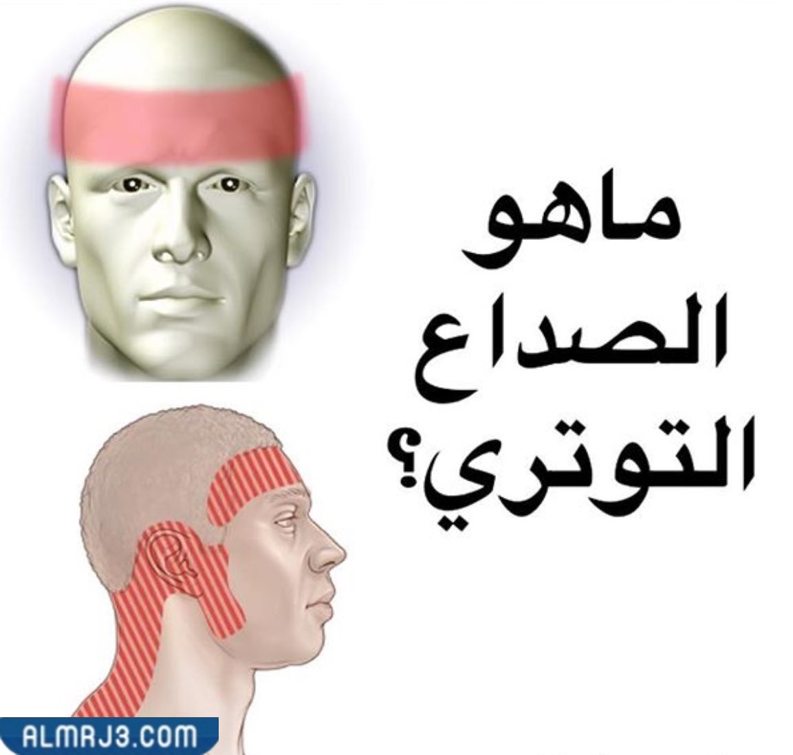 انواع الصداع بالصور وطرق التخلص منه - موقع المرجع