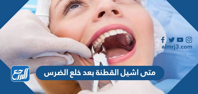 متى اشيل القطنة بعد خلع الضرس موقع المرجع