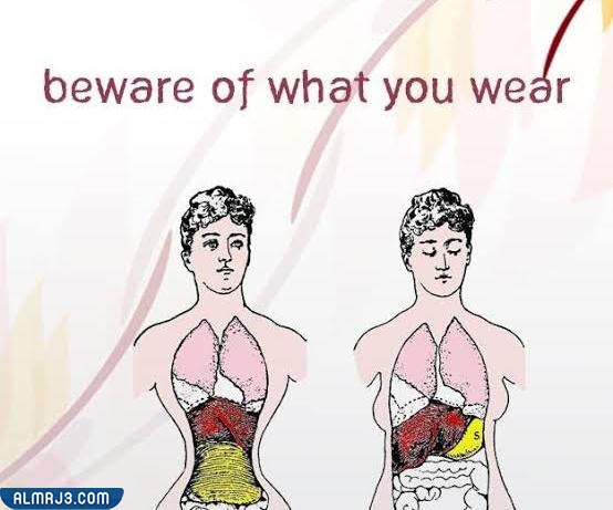 أضرار مشد البطن للرجال