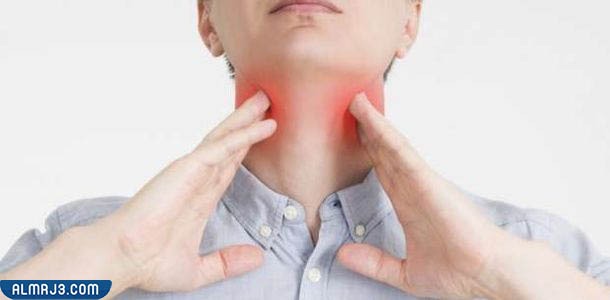 أعراض الإصابة بالتهاب الحلق