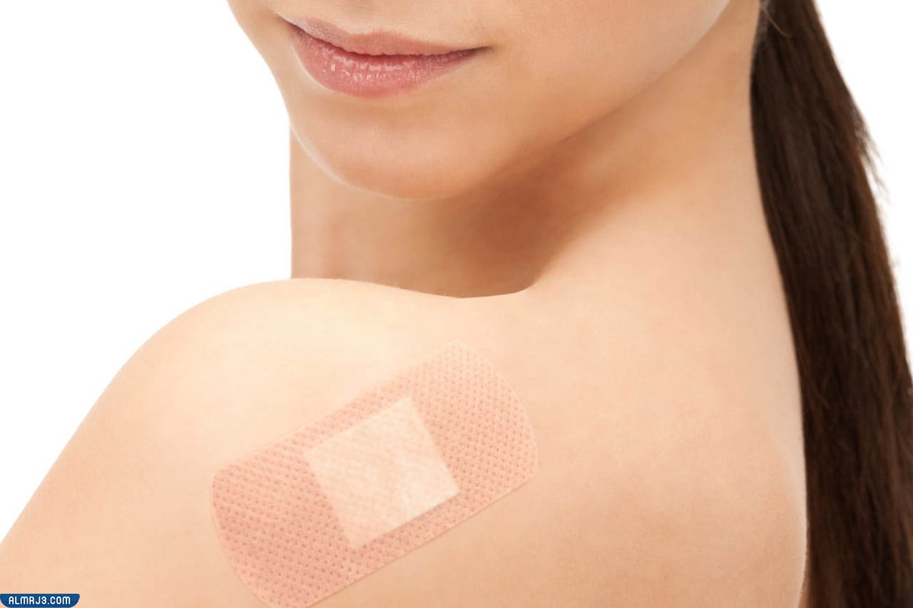 أين تُوضع لصقات منع الحمل