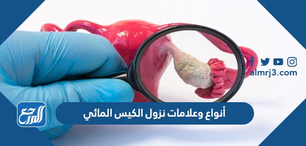 أنواع وعلامات نزول الكيس المائي