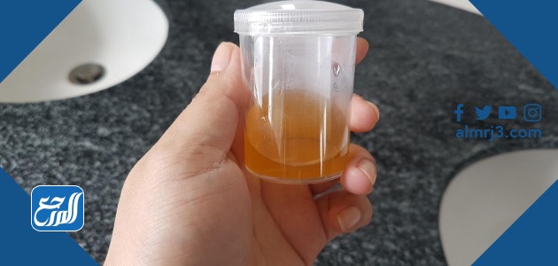 اختبار الحمل بالبول