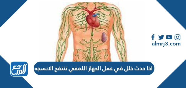 اذا حدث خلل في عمل الجهاز اللمفي تنتفخ الانسجه