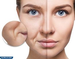 التجربة الثانية التخلص من التجاعيد عن طريق تحفيز الجهاز للكولاجين