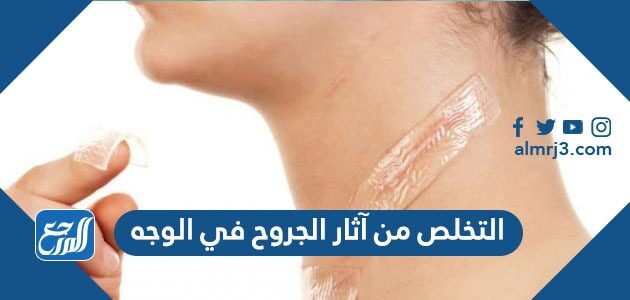 التخلص من آثار الجروح في الوجه