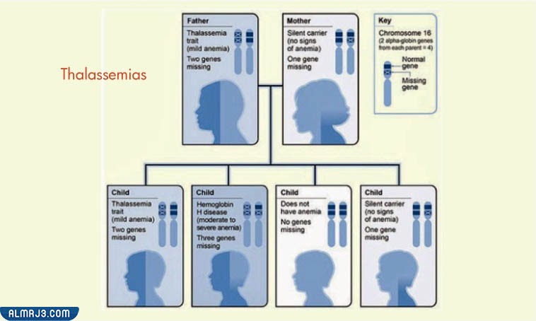 الثلاسيميا
