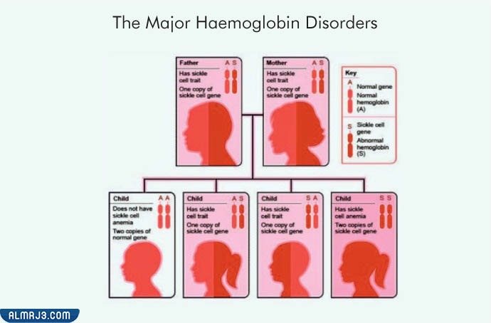 الثلاسيميا